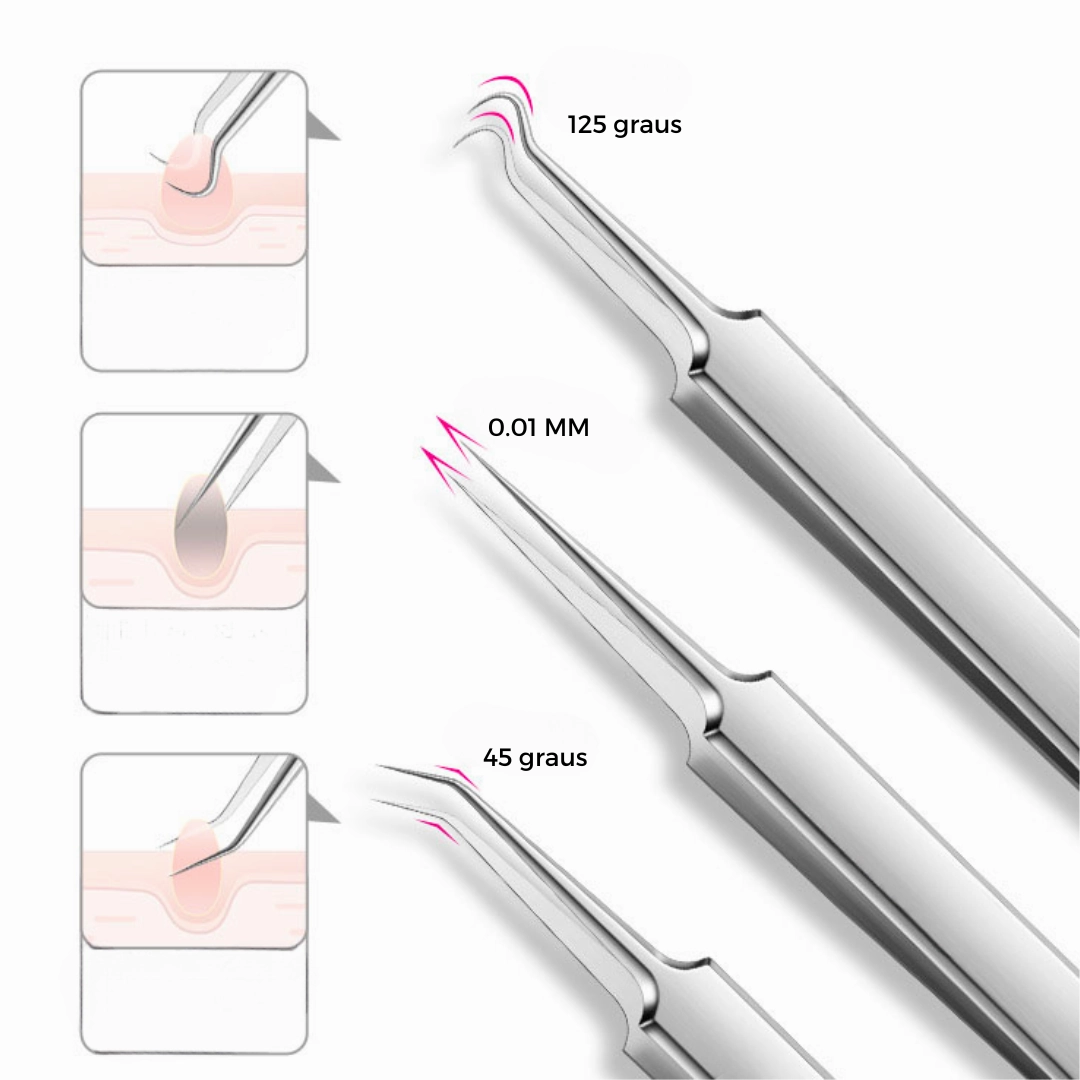 The Tweezers