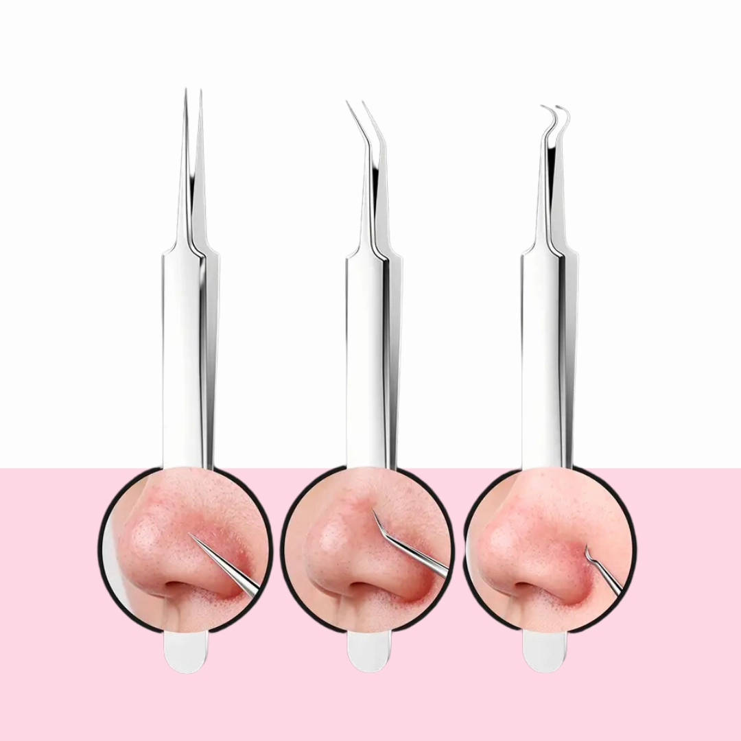 The Tweezers